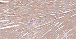 MFN1 Antibody in Immunohistochemistry (Paraffin) (IHC (P))