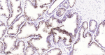 ADAM10 Antibody in Immunohistochemistry (Paraffin) (IHC (P))