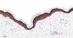 TROP2 Antibody in Immunohistochemistry (Paraffin) (IHC (P))