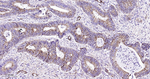 AMACR Antibody in Immunohistochemistry (Paraffin) (IHC (P))