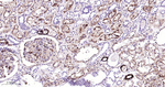 AMACR Antibody in Immunohistochemistry (Paraffin) (IHC (P))