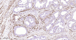 AMACR Recombinant Rabbit Monoclonal Antibody (H4A1)