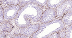 AMACR Antibody in Immunohistochemistry (Paraffin) (IHC (P))