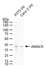 AMACR Antibody in Western Blot (WB)