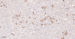 TSH beta Recombinant Rabbit Monoclonal Antibody (D7C6)