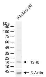 TSH beta Antibody in Western Blot (WB)