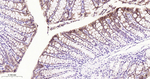CDH17 Antibody in Immunohistochemistry (Paraffin) (IHC (P))
