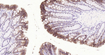 CDH17 Antibody in Immunohistochemistry (Paraffin) (IHC (P))