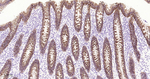 CDH17 Antibody in Immunohistochemistry (Paraffin) (IHC (P))