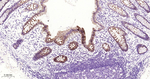 CDH17 Antibody in Immunohistochemistry (Paraffin) (IHC (P))
