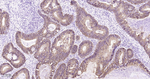 CDH17 Antibody in Immunohistochemistry (Paraffin) (IHC (P))