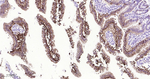 CDH17 Recombinant Rabbit Monoclonal Antibody (B5A7)