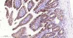 CDH17 Antibody in Immunohistochemistry (Paraffin) (IHC (P))