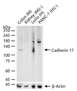 CDH17 Antibody in Western Blot (WB)