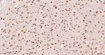 DYNLL1 Recombinant Rabbit Monoclonal Antibody (B3F3)