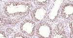 DYNLL1 Antibody in Immunohistochemistry (Paraffin) (IHC (P))