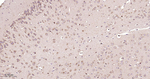 PTPN2 Antibody in Immunohistochemistry (Paraffin) (IHC (P))