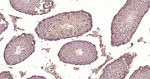 PTPN2 Antibody in Immunohistochemistry (Paraffin) (IHC (P))