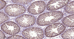 PTPN2 Antibody in Immunohistochemistry (Paraffin) (IHC (P))