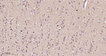 PTPN2 Monoclonal Antibody (F3H2)