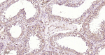 PTPN2 Antibody in Immunohistochemistry (Paraffin) (IHC (P))