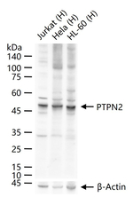 PTPN2 Antibody in Western Blot (WB)