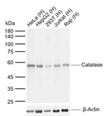 Catalase Antibody in Western Blot (WB)