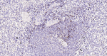 CD23 Antibody in Immunohistochemistry (Paraffin) (IHC (P))