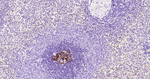 CD23 Antibody in Immunohistochemistry (Paraffin) (IHC (P))