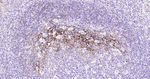 CD23 Recombinant Rabbit Monoclonal Antibody (C2F9)