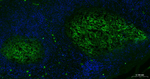 CD23 Antibody in Immunohistochemistry (Paraffin) (IHC (P))