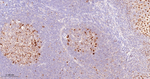 JunB Antibody in Immunohistochemistry (Paraffin) (IHC (P))