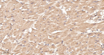 PCK2 Antibody in Immunohistochemistry (Paraffin) (IHC (P))