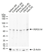 PCK2 Antibody in Western Blot (WB)