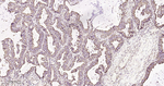 HSPE1 Antibody in Immunohistochemistry (Paraffin) (IHC (P))