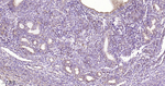 HSPE1 Antibody in Immunohistochemistry (Paraffin) (IHC (P))