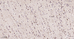 HSPE1 Antibody in Immunohistochemistry (Paraffin) (IHC (P))