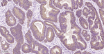 HSPE1 Antibody in Immunohistochemistry (Paraffin) (IHC (P))