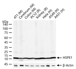 HSPE1 Antibody in Western Blot (WB)