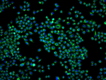 BAP31 Recombinant Rabbit Monoclonal Antibody (D10C11)