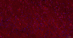 BAP31 Antibody in Immunohistochemistry (Paraffin) (IHC (P))