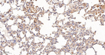 BAP31 Antibody in Immunohistochemistry (Paraffin) (IHC (P))