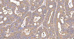 BAP31 Antibody in Immunohistochemistry (Paraffin) (IHC (P))