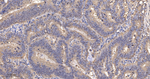 EEF1G Antibody in Immunohistochemistry (Paraffin) (IHC (P))