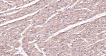 ACADM Antibody in Immunohistochemistry (Paraffin) (IHC (P))
