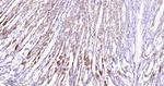ACADM Recombinant Rabbit Monoclonal Antibody (H5A10)