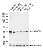 ACADM Antibody in Western Blot (WB)
