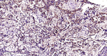 RPS20 Antibody in Immunohistochemistry (Paraffin) (IHC (P))
