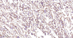RPS20 Antibody in Immunohistochemistry (Paraffin) (IHC (P))
