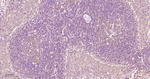 RPS20 Antibody in Immunohistochemistry (Paraffin) (IHC (P))